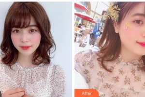 江蘇省第二中醫(yī)院眼科王煒整形價格表附眼部綜合案例展示