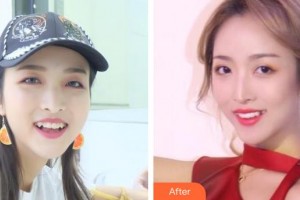 江蘇省口腔醫(yī)院章非敏整形價格表附牙齒隱形矯正案例展示