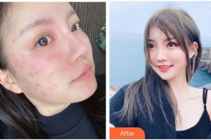 石家莊黛芙醫(yī)療美容診所戴輝整形價(jià)格表附激光祛斑案例展示