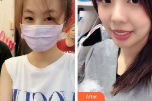 石家莊專家團(tuán)醫(yī)院胎記色斑診療中心何小東整形價格表附激光祛斑案例展示