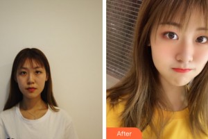 武漢麗臻醫(yī)療美容門診部李海濤整形價(jià)格表附眼部手術(shù)案例展示