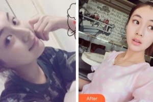 石家莊俏之翼醫(yī)療美容門診部姜凱整形價格表附光子嫩膚案例展示