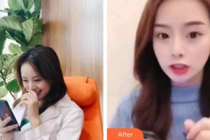 石家莊雅芳亞醫(yī)療美容醫(yī)院程雪艷整形價(jià)格表附超聲波潔牙案例展示