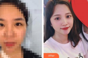 石家莊愛瑞爾醫(yī)療美容診所盧娜整形價(jià)格表附祛斑祛痣案例展示