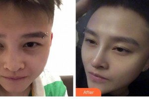 唐山美泉醫(yī)療美容診所王首燕整形價格表附鼻部綜合案例展示