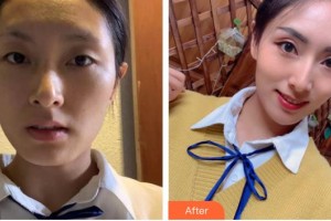 唐山美聯(lián)臣醫(yī)療美容醫(yī)院文丁一整形價(jià)格表附埋線(xiàn)提升案例展示