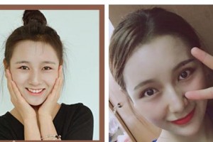 唐山美尚醫(yī)療美容診所趙晟弼整形價(jià)格表附眼部綜合案例展示