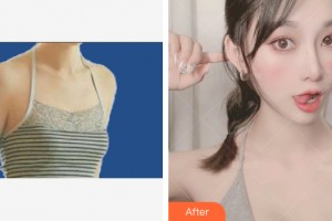 ?？跂|湖醫(yī)學美容整形醫(yī)院周旭剛整形價格表附自體脂肪豐胸案例展示