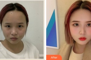 ?？诩t妝尚醫(yī)療美容門診部李杰整形價格表附皮膚美容案例展示