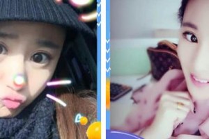 秦皇島二偉醫(yī)療美容診所王二偉整形價(jià)格表附眼部綜合案例展示