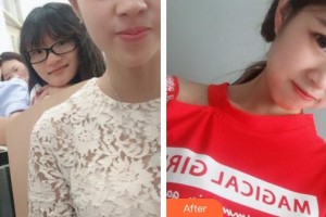 秦皇島愛爾眼科醫(yī)院錢曼整形價(jià)格表附眼部綜合案例展示