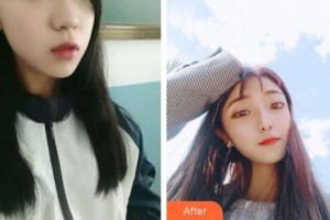 唐山冀東眼科醫(yī)院徐斌整形價(jià)格表附切開雙眼皮案例展示