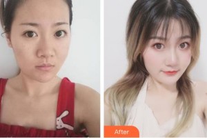 唐山冀東眼科醫(yī)院楊露整形價(jià)格表附眼部綜合案例展示