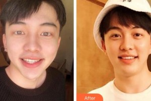 唐山牙博士口腔醫(yī)院張賀萍整形價(jià)格表附美白貼片案例展示