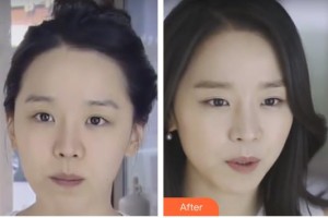 邯鄲都市整形美容醫(yī)院魯樹榮整形價(jià)格表附激光除皺案例展示