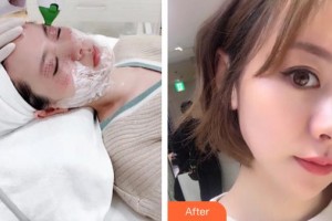 邯鄲都市整形美容醫(yī)院許川整形價格表附熱瑪吉案例展示