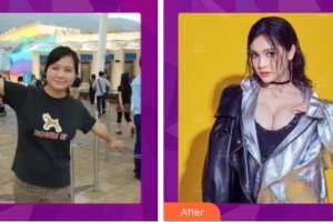 保定華美整形美容醫(yī)院胡慶旭整形價格表附假體隆胸案例展示