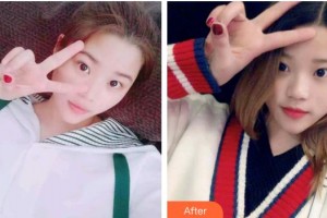 保定牙博士口腔醫(yī)院蘇帆整形價格表附冷光美白案例展示