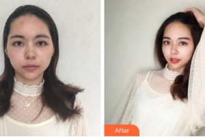 中山愛思特美容醫(yī)院　徐紅梅整形價格表附紋眉案例展示