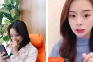 保定東陽口腔醫(yī)院張亞靜住院醫(yī)師整形價格表附超聲波潔牙案例展示