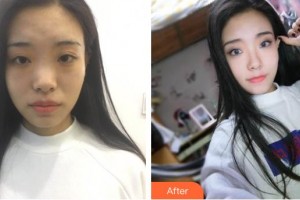 滄州靜港醫(yī)療美容診所季澤東院長整形價格表附鼻部綜合案例展示