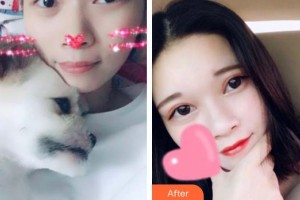 滄州眼科醫(yī)院李亞楠整形價(jià)格表附定點(diǎn)雙眼皮案例展示