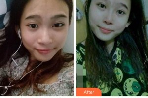 廊坊榮霞醫(yī)療美容診所常秀芬整形價(jià)格表附鼻部綜合案例展示