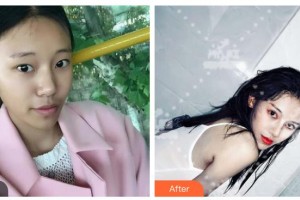 衡水尚美醫(yī)療美容門診部周林帥整形價(jià)格表附切開雙眼皮案例展示