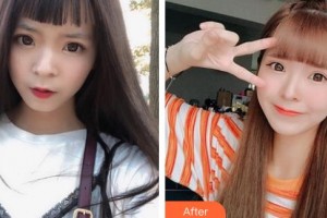 太原晉容整形美容門診部盧永佑整形價(jià)格表附硅膠隆鼻案例展示