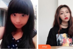 太原塑美美容整形門診部樊捷文整形價格表附熱瑪吉案例展示