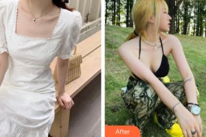 貴陽麗都醫(yī)療美容醫(yī)院孫振東整形價(jià)格表附隆胸手術(shù)案例展示