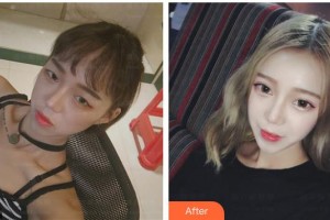 太原愛爾眼科醫(yī)院衛(wèi)留根整形價(jià)格表附眼部綜合案例展示