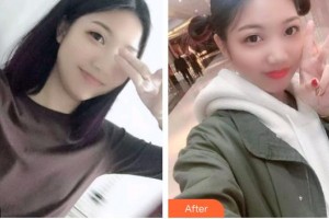 太原愛爾眼科醫(yī)院劉愛平整形價(jià)格表附眼部綜合案例展示