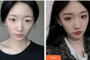 大同美神整形美容醫(yī)院王玉秀整形價(jià)格表附祛斑祛痣案例展示