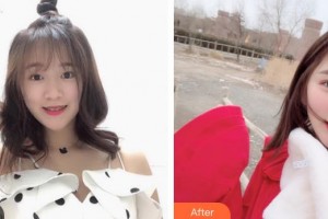 大同市第二人民醫(yī)院整形燒傷外科駱強(qiáng)整形價格表附鼻部綜合案例展示