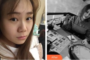 大同紅太陽醫(yī)療美容診所周研君整形價格表附鼻部綜合案例展示