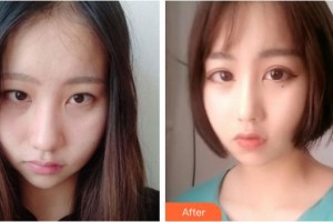 陽泉美亞醫(yī)療美容診所杜飛雪整形價格表附鼻部綜合案例展示