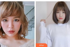 晉城修形美林整形醫(yī)院郭明雷整形價格表附切開雙眼皮案例展示