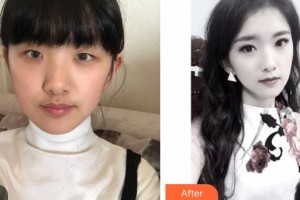 運(yùn)城市眼科醫(yī)院曲驗(yàn)兵整形價(jià)格表附激光去眼袋案例展示