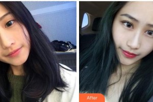 運城市眼科醫(yī)院武廣智整形價格表附切開雙眼皮案例展示