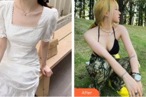 南昌愛思特醫(yī)療美容醫(yī)院胡秀龍整形價格表附隆胸手術(shù)案例展示