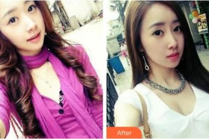 臨汾憶佳星醫(yī)療美容門診部肖建華整形價(jià)格表附硅膠隆鼻案例展示