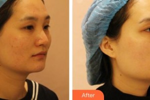 臨汾堯都恒信齒科診所盧國(guó)柱整形價(jià)格表附激光祛斑案例展示