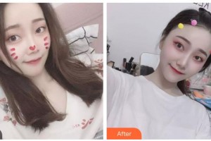 內(nèi)蒙古林業(yè)總醫(yī)院燒傷整形科姚荔湘整形價格表附紅藍光祛痘案例展示