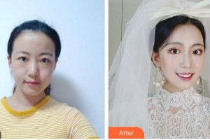 呼和浩特華醫(yī)醫(yī)療美容門診部趙彥波整形價格表附眼部綜合案例展示