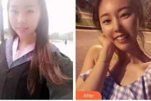 呼和浩特董志新口腔門診部張建明整形價(jià)格表附牙齒陶瓷矯正案例展示