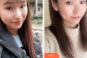 呼和浩特董志新口腔門診部楊艷整形價(jià)格表附牙貼面案例展示