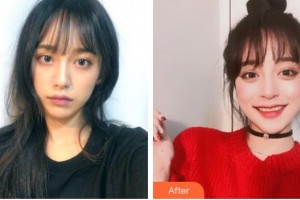 包頭伽藍（原巴諾巴奇)醫(yī)療美容醫(yī)院王林琳整形價格表附光子嫩膚例展示