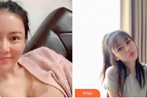 包頭貝特瑞爾口腔門診部安順凱整形價格表附美白劑美白牙齒案例展示