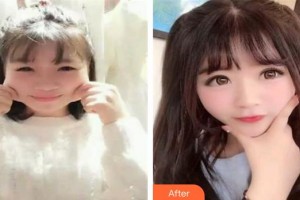 赤峰康華皮膚病醫(yī)院陳海昆整形價(jià)格表附埋線雙眼皮案例展示